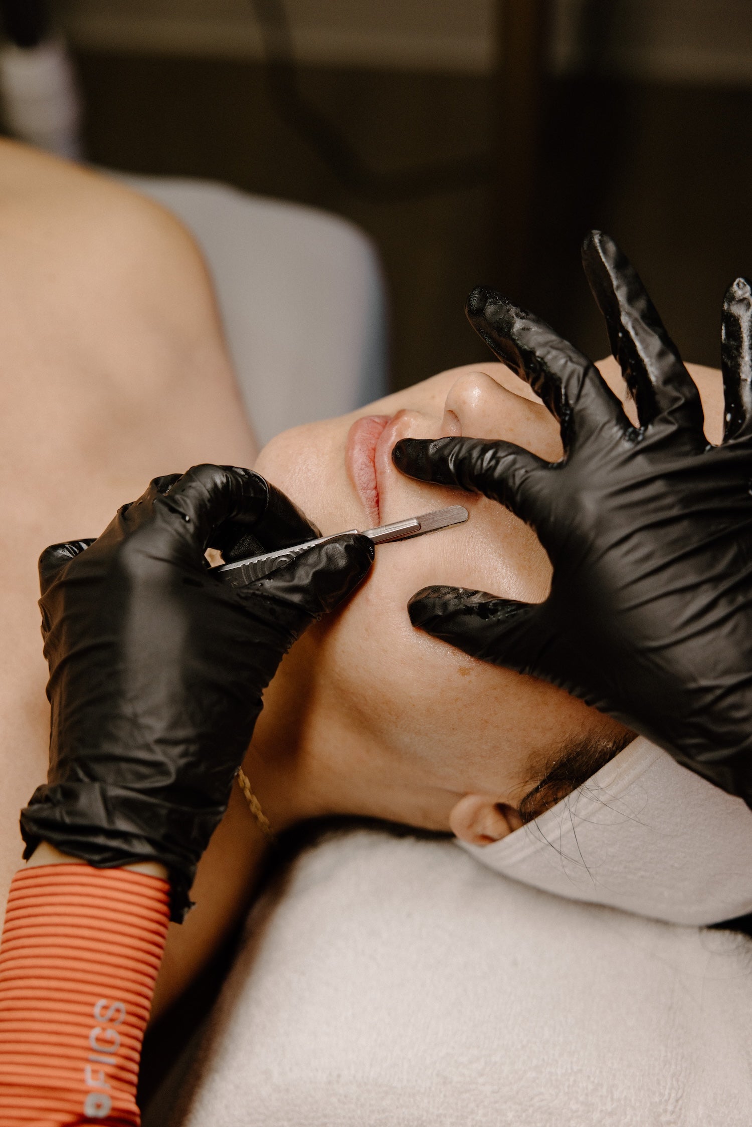 Dermaplaning treatment — clinical blade at face with gloved hands