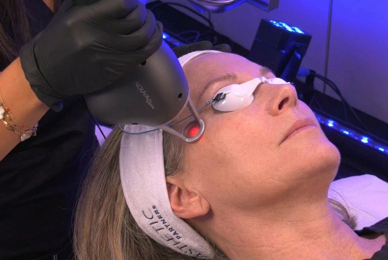 Laser Treatments